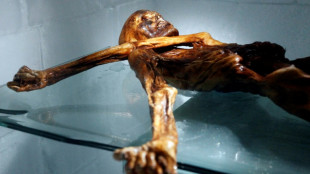 Ötzi, el "hombre de las nieves" tenía piel oscura y calvicie