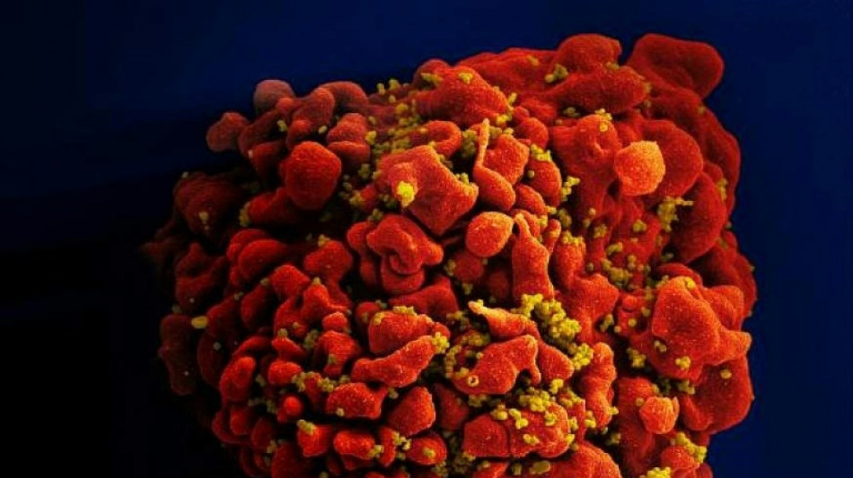 New 'highly virulent' HIV strain discovered in the Netherlands