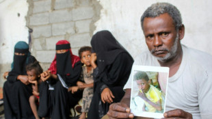 Las minas pulverizan a habitantes de Yemen pese a aparente calma en el conflicto