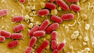 Drug-resistant superbugs projected to kill 39 million by 2050