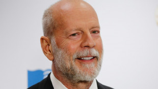 L'acteur Bruce Willis souffre d'une forme de démence incurable