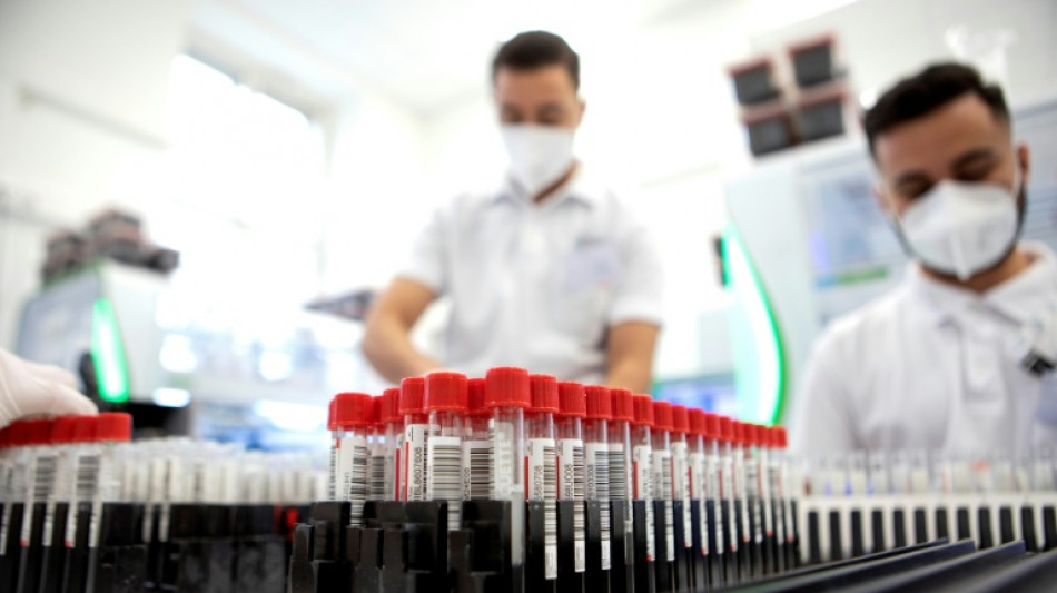 Lauterbach vollzieht Kehrtwende: Anspruch auf PCR-Nachtestung bleibt